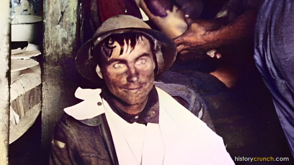 Shell Shock World War I