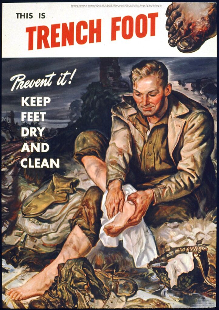 Trench Foot World War I